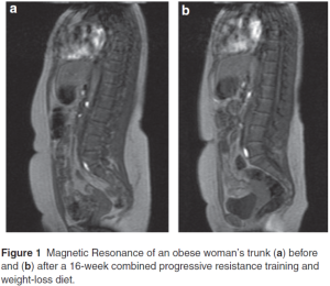 Idoate & Izquierdo 2010 & 2011 mri visceral adipose fat weight lifting diet research study