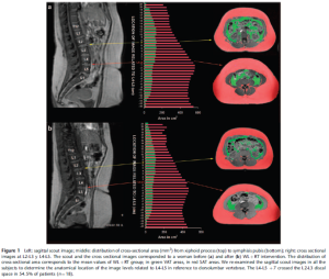 Idoate & Izquierdo 2010 & 2011 mri visceral adipose fat weight lifting diet research study