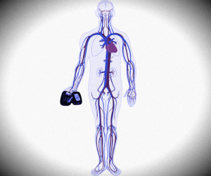 Ross 1999 research study weight loss calories fat muscle cardio resistance exercise blood glucose insulin diabetes